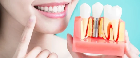 Are Dental Implants Right for You? Assessing Candidacy