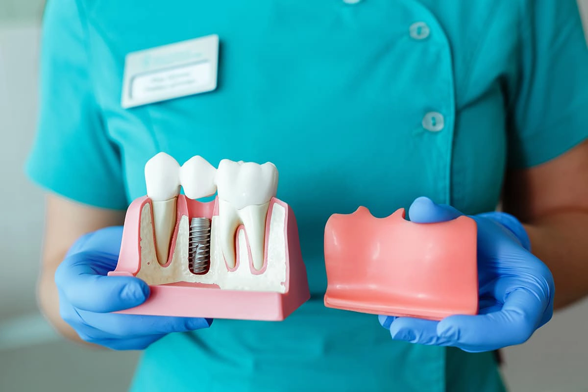 Common Misconceptions About Dental Implants