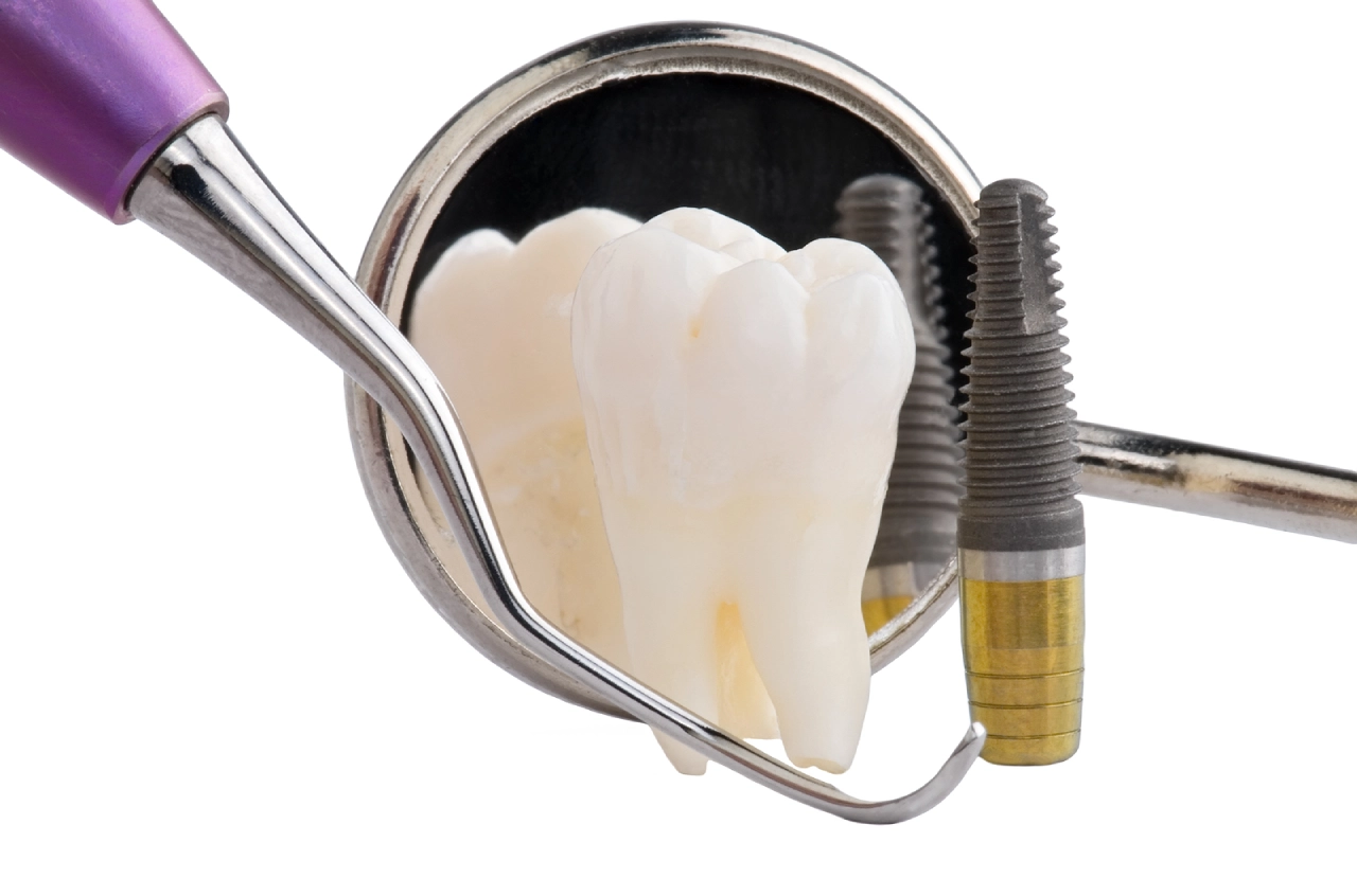 Dental Implants Complications_ Prevention and Solutions