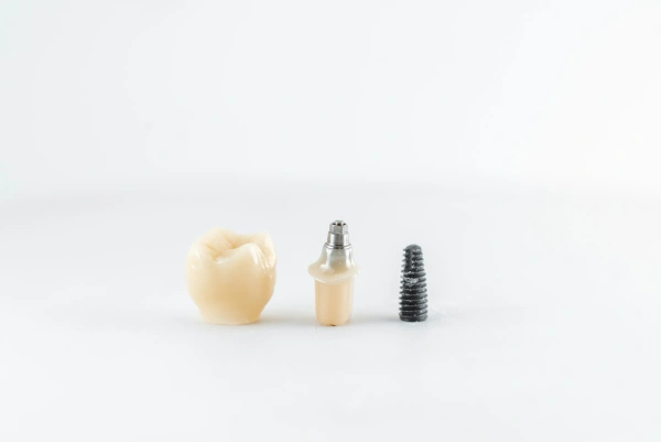 Dental implants with screw and crown in jordan amman