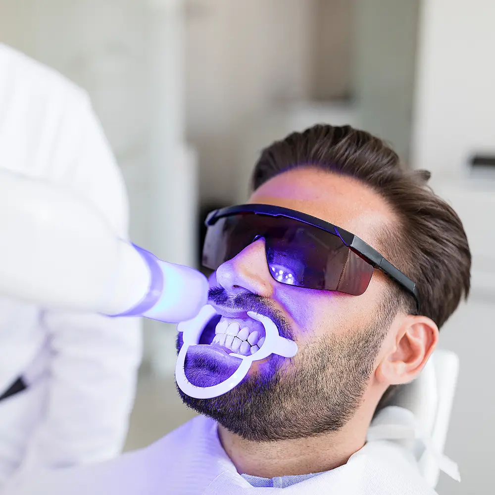 Teeth Whitening in Amman, Jordan​