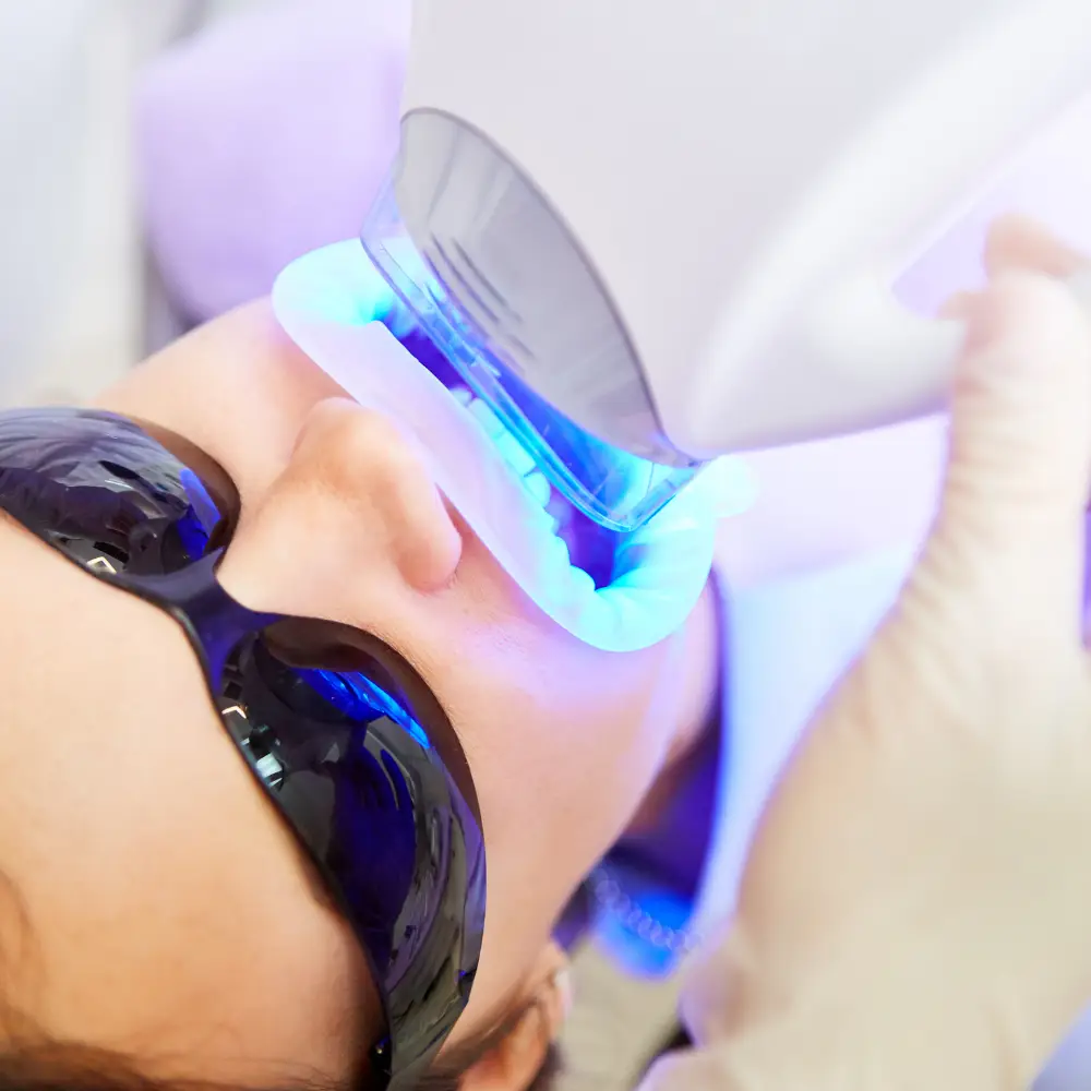 Teeth Whitening in Amman, Jordan​