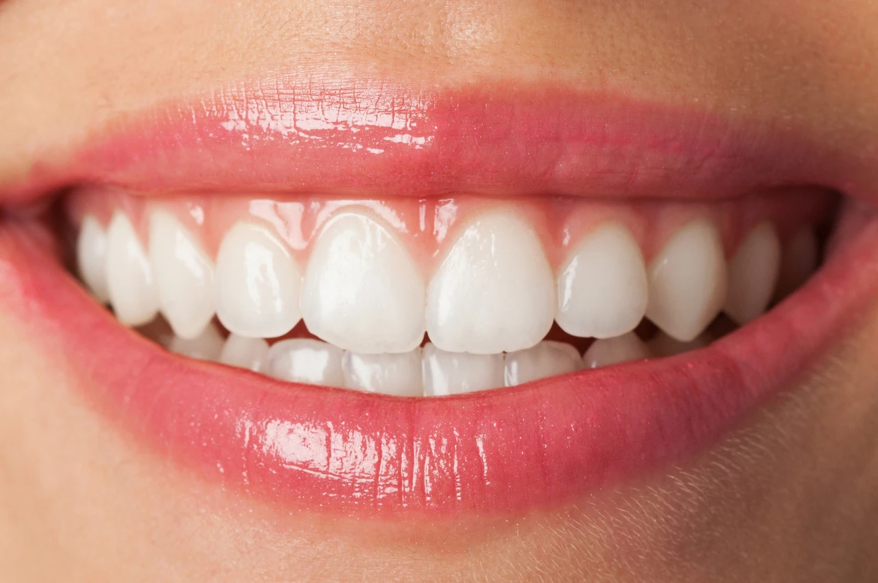 Gummy Smile Surgery by Dr. Khaled Al Sayed at modern dental facility in Amman, Jordan with advanced tools